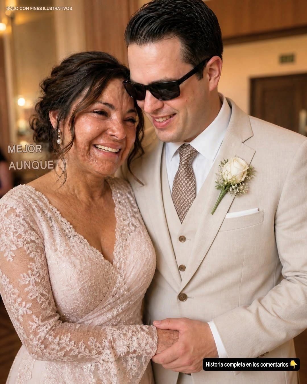 Me casé con un hombre ciego porque pensé que nunca vería mis cicatrices, pero en nuestra noche de bodas, reveló un secreto que lo cambió todo